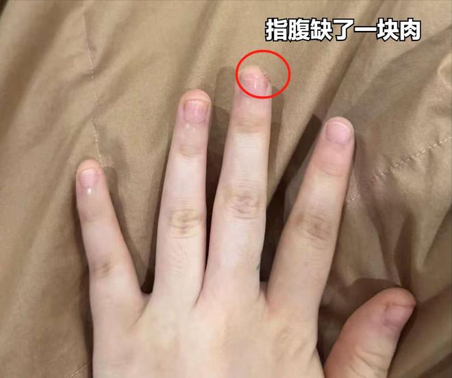 江苏女子上班切破手竟向老板索赔5000未谈妥直接曝光店铺黑料(图9)